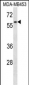 FANCG Antibody (C-term)