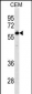 TBX5 Antibody (N-term)