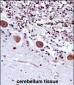 TRA2B Antibody (Center)