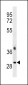 TRA2B Antibody (Center)