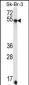 SDC3 Antibody (C-term)