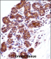 IMPDH1 Antibody (N-term)