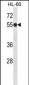 IMPDH1 Antibody (N-term)