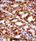 PAX7 Antibody (Center)