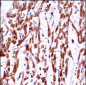 TMM85 Antibody (N-term)