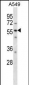 LSM14A Antibody (C-term)