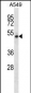 NUDCD1 Antibody (Center)