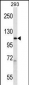 POLR2B Antibody (Center)