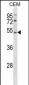 P2RY2 Antibody (C-term)