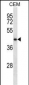 NDRG2 Antibody (N-term)