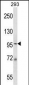 MCM6 Antibody (N-term)