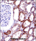 CD70 Antibody (Center)