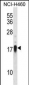 CD70 Antibody (Center)