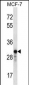 GRAP2 Antibody (Center)