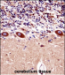 KCNA1 Antibody (Center)