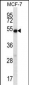 COIL Antibody (Center)