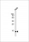 UBE2D2 Antibody (C-term)