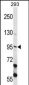 ECT2 Antibody (Center)