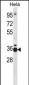 TCEA1 Antibody (Center)