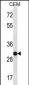 SNRPA Antibody (Center)