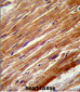 MEKK4 Antibody (Center C1081)