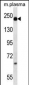 A2M Antibody (N-term)