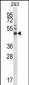 FOXA1 Antibody (Center S286)