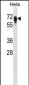 CD55 Antibody (N-term)