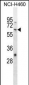 WHSC2 Antibody (Center)