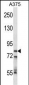 CPSF3 Antibody (Center)