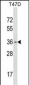 OTX1 Antibody (Center)