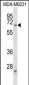 FZD2 Antibody (C-term)