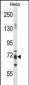 PJA1 Antibody (N-term)