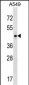 PTX3 Antibody (Center)