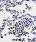 CYSLTR1 Antibody (Center)