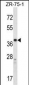 CYSLTR1 Antibody (Center)