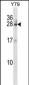 RAB3A Antibody (N-term)