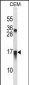 CXCL11 Antibody (C-term)