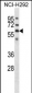 GPC3 Antibody (C-term)