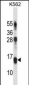 LY86 Antibody (C-term)