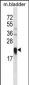 LY86 Antibody (C-term)