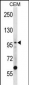 LIG1 Antibody (N-term)