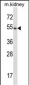 Mouse Frk Antibody (C-term)