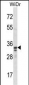 SPI1 Antibody (C-term)