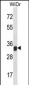 LGALS9 Antibody (N-term)