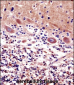 CDR2 Antibody (C-term)