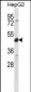 CDR2 Antibody (C-term)