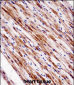 NR1D2 Antibody (Center)