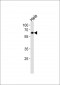 NR1D2 Antibody (Center)