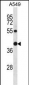 RAD23B Antibody (N-term)